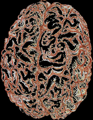 brain_2